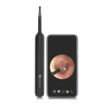 Portronics Xlife Smart Wireless Ear Otoscope Cleaner with 6 LED Lights, FHD 1080 Camera at ₹699 | Zepto Deal Portronics Xlife Smart Wireless Ear Otoscope Cleaner with 6 LED Lights, FHD 1080 Camera at ₹699 | Zepto Deal